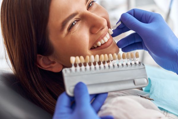 Surprising Benefits Of Dental Veneers You Did Not Know